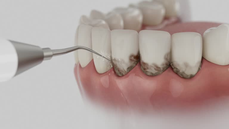 Trusted Dental Crowns And Bridges service in Jonesboro, AR - Dentist Open Now